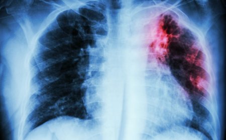 WORLD TB DAY 2024, THEME: “YES, WE CAN END TB”