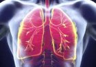 PNEUMONIA: WHAT YOU NEED TO KNOW ABOUT THE DISEASE