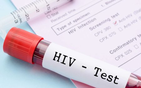 KENYA ADVANCES HIV TESTING PRECISION AND AFFIRMS COMMITMENT TO QUALITY SERVICES