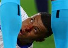 Update On  Mbappe’s  Injury