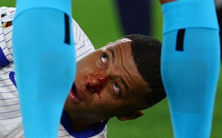 Update On  Mbappe’s  Injury