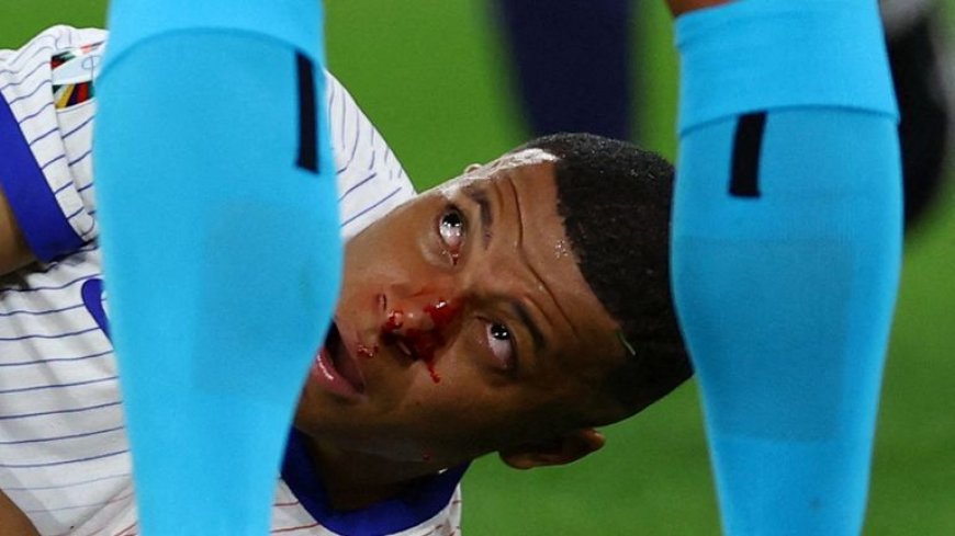 Update On  Mbappe’s  Injury